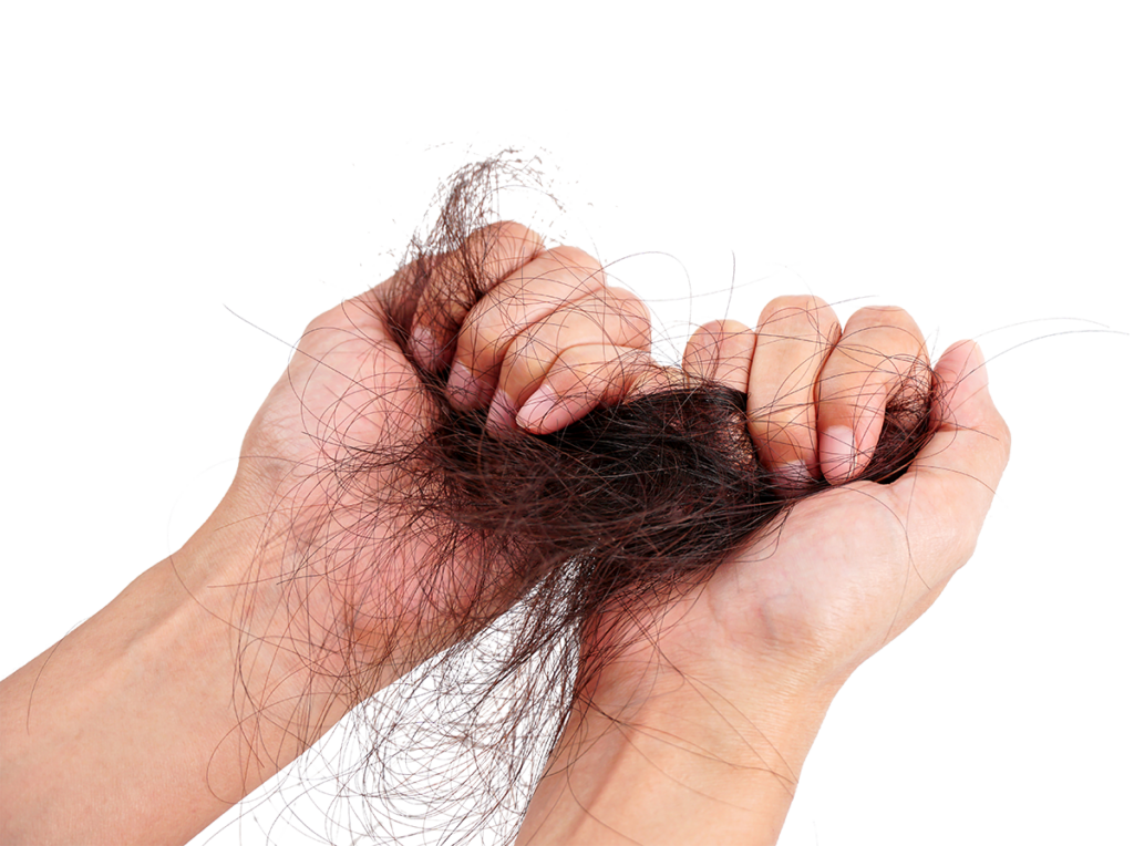 Chemotherapie und Haarausfall gehören fast schon zusammen. Die Nebenwirkungen diverser Chemotherapeutika umfassen u. a. auch Haarausfall